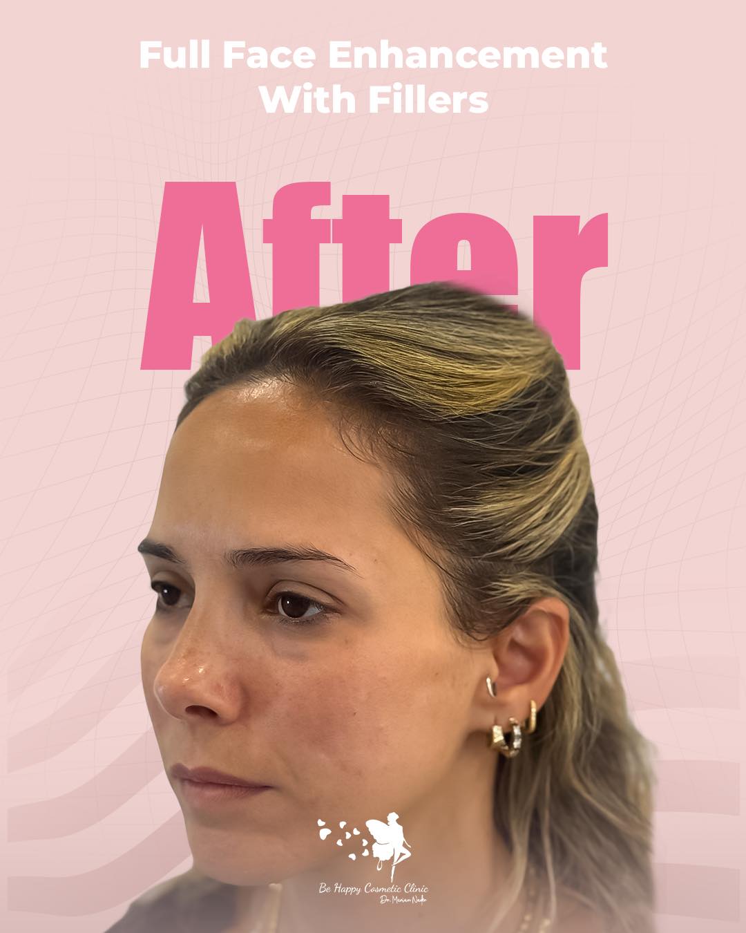 Full face enhancement after side profile result